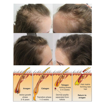Rice Shampoo Soap Hair Growth Anti-hair Loss Nourishing Hair Strengthening Deep Cleansing