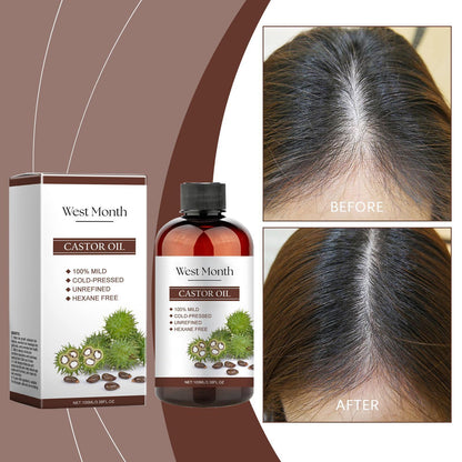 Xiyue All-in-one Castor Oil Is An Essential Oil For Multi-effect Care, Moisturizing Skin, Eyelashes And Eyebrows